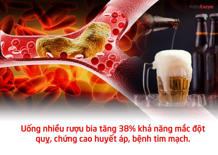 Uống nhiều rượu, bia không những gia tăng khả năng mắc bệnh đột quỵ mà còn làm tăng khả năng mắc chứng cao huyết áp và ảnh hưởng xấu đến tim mạch. Ảnh: Báo Sức khỏe đời sống. Uống nhiều rượu, bia không những gia tăng khả năng mắc bệnh đột quỵ mà còn làm tăng khả năng mắc chứng cao huyết áp và ảnh hưởng xấu đến tim mạch. Ảnh: Báo Sức khỏe đời sống.