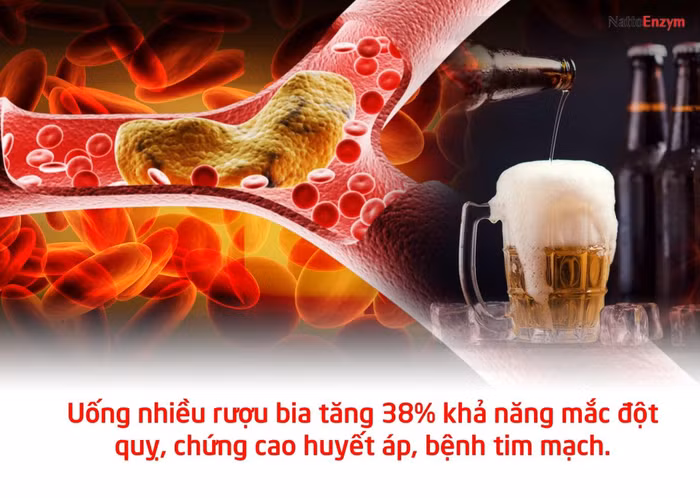 Uống nhiều rượu, bia không những gia tăng khả năng mắc bệnh đột quỵ mà còn làm tăng khả năng mắc chứng cao huyết áp và ảnh hưởng xấu đến tim mạch. Ảnh: Báo Sức khỏe đời sống.