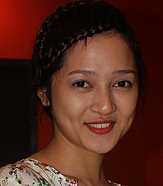 "Thiên thần đỏ" Bảo Anh cũng sở hữu vô số chấm mụn trên trán, và cả mụn cám ở cằm. "Thiên thần đỏ" Bảo Anh cũng sở hữu vô số chấm mụn trên trán, và cả mụn cám ở cằm.