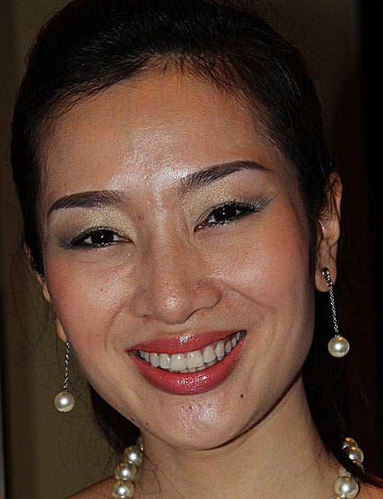 Hoa khôi thể thao Thu Hương cũng là "nạn nhân" của những đốm mụn đỏ. Hoa khôi thể thao Thu Hương cũng là "nạn nhân" của những đốm mụn đỏ.