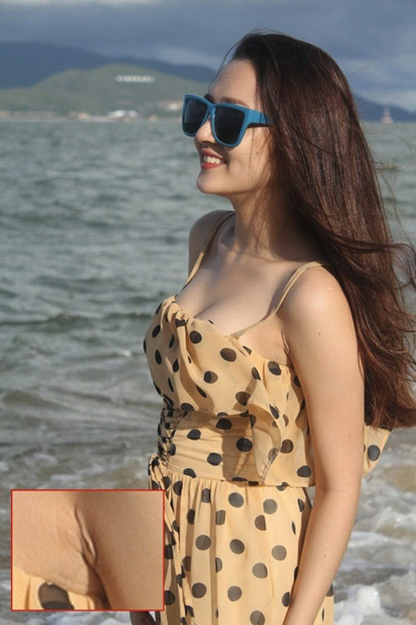 Cô nàng xinh đẹp của The Voice lại sở hữu một vùng da dưới cánh tay nhăn nheo, xấu xí Cô nàng xinh đẹp của The Voice lại sở hữu một vùng da dưới cánh tay nhăn nheo, xấu xí