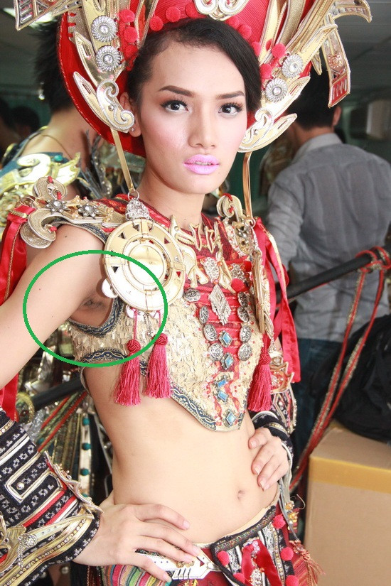 Trong một show thời trang diễn ra tối 20/1 vừa qua, hình ảnh 'vùng cánh' thâm đen của người mẫu Cù Ngọc Quý đã vô tình lạc vào ống kính phóng viên Trong một show thời trang diễn ra tối 20/1 vừa qua, hình ảnh 'vùng cánh' thâm đen của người mẫu Cù Ngọc Quý đã vô tình lạc vào ống kính phóng viên