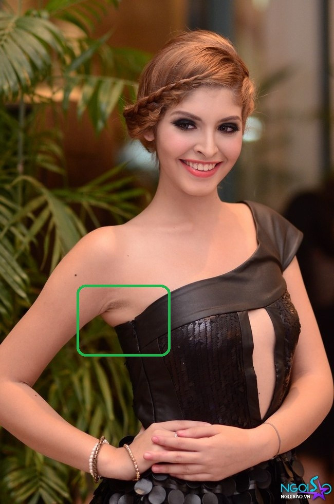 Mẫu trẻ Andrea với vùng da dưới cánh tay vẫn còn lởm chởm vết tích của lông Mẫu trẻ Andrea với vùng da dưới cánh tay vẫn còn lởm chởm vết tích của lông