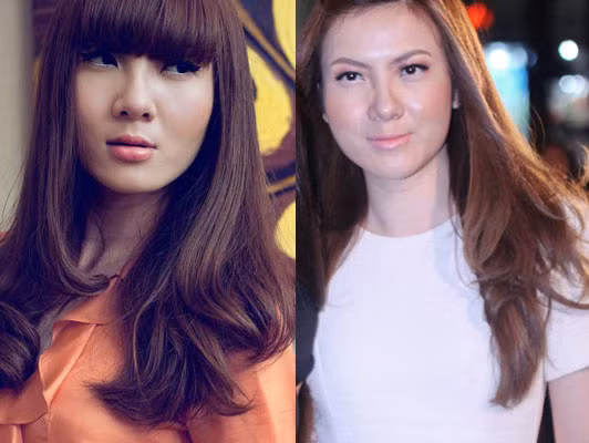 Yến Nhi từng có lần không dám ra đường vì gương mặt sưng phù Yến Nhi từng có lần không dám ra đường vì gương mặt sưng phù