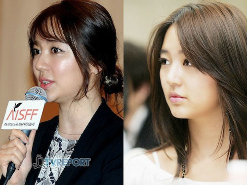 "Thái tử phi" của showbiz Hàn Quốc - Yoon Eun Hye gây sốc vì gương mặt cứng đơ, sưng phù và bóng nhẫy (trái) trong sự kiện diễn ra các đây vài ngày