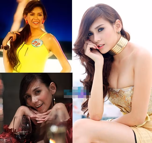 Đầu mũi khá to và không gọn khiến cô nàng Võ Hoàng Yến quyết định làm một cuộc "cách mạng" cho chiếc mũi dọc dừa của mình.