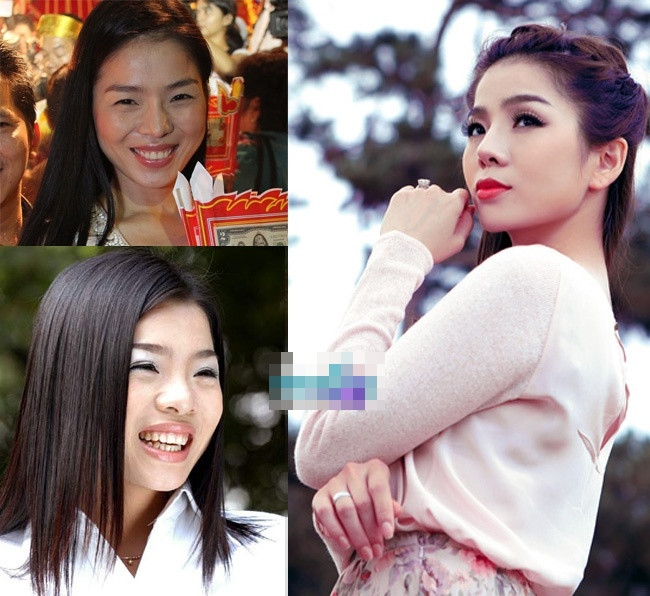 Trước đây, chiếc mũi của Lệ Quyên khá to và thô, chưa kể đến phần đầu mũi "cà chua" choáng gần hết gương mặt. Tuy nhiên, sau cuộc thẩm mỹ, chiếc mũi xấu xí lại trở thành niềm tự hào của ca sĩ "Giấc mơ có thật". Trước đây, chiếc mũi của Lệ Quyên khá to và thô, chưa kể đến phần đầu mũi "cà chua" choáng gần hết gương mặt. Tuy nhiên, sau cuộc thẩm mỹ, chiếc mũi xấu xí lại trở thành niềm tự hào của ca sĩ "Giấc mơ có thật".