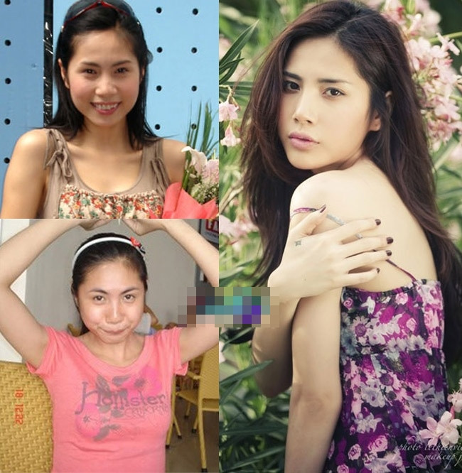 "Người đẹp dao kéo" Thủy Tiên và cú "lột xác" ngoạn mục nhờ nâng mũi. "Người đẹp dao kéo" Thủy Tiên và cú "lột xác" ngoạn mục nhờ nâng mũi.