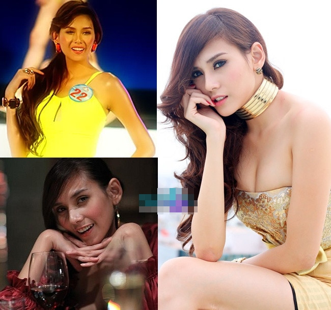 Đầu mũi khá to và không gọn khiến cô nàng Võ Hoàng Yến quyết định làm một cuộc "cách mạng" cho chiếc mũi dọc dừa của mình. Đầu mũi khá to và không gọn khiến cô nàng Võ Hoàng Yến quyết định làm một cuộc "cách mạng" cho chiếc mũi dọc dừa của mình.