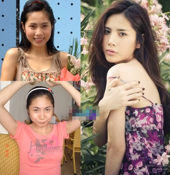 "Người đẹp dao kéo" Thủy Tiên và cú "lột xác" ngoạn mục nhờ nâng mũi.