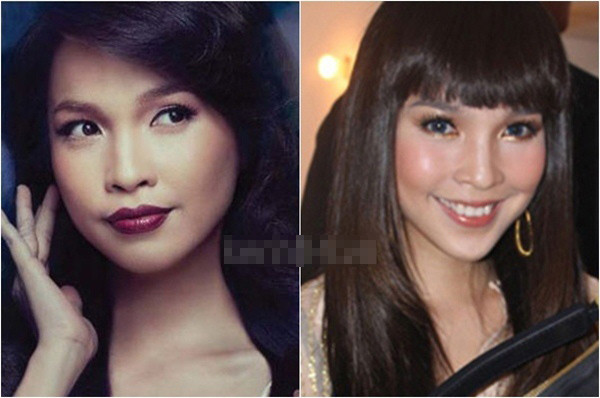 Hiền Thục trẻ hơn khi sửa cằm.