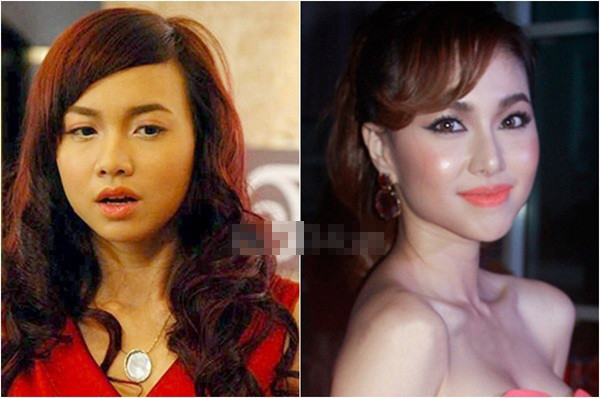 Đinh Ngọc Diệp cũng mê cằm chữ "V" sau một thời gian tham gia làng giải trí.