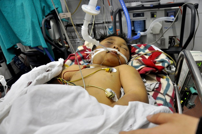 Theo nhận định của các bác sỹ tại BV Việt Đức, cháu Lộc khó có thể qua khỏi... (Ảnh GDVN) Theo nhận định của các bác sỹ tại BV Việt Đức, cháu Lộc khó có thể qua khỏi... (Ảnh GDVN)