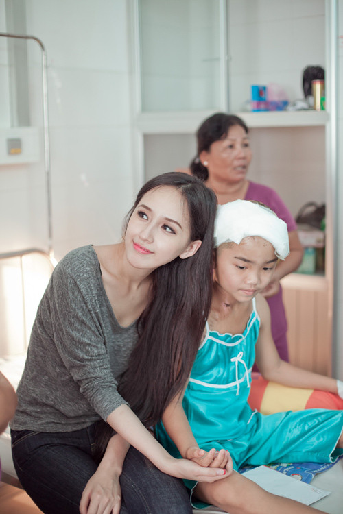 Bệnh nhân được BS. Nguyễn Hữu Tính, chuyên phẫu thuật vi phẫu tạo hình, mổ cấp cứu khâu nối mạch máu và mảnh da bị tróc. Hiện bé Như Ý đã ăn uống được, phần da đầu ghép đã hồng, ấm. Bệnh nhân được BS. Nguyễn Hữu Tính, chuyên phẫu thuật vi phẫu tạo hình, mổ cấp cứu khâu nối mạch máu và mảnh da bị tróc. Hiện bé Như Ý đã ăn uống được, phần da đầu ghép đã hồng, ấm.