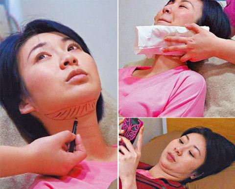 Trang Tư Mẫn đi loại bỏ mỡ cằm vào cuối năm ngoái.