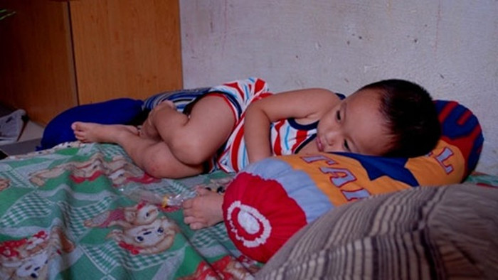 3 ngày sau khi sự việc xảy ra, cháu Hòa - bé đã bị hành hạ trước đó tại nhà trẻ Phương Anh vẫn hồn nhiên cười đùa, chưa ý thức được những gì mình phải chịu đựng (Ảnh Infonet)