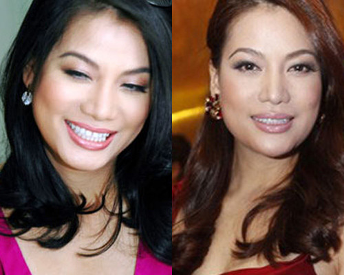 Chiếc cằm vuông của Trương Ngọc Ánh giờ đây đã chuyển sang hơi nhọn.