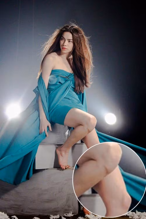 Hồ Ngọc Hà đầu gối xương xẩu lộ hẳn ra ngoài