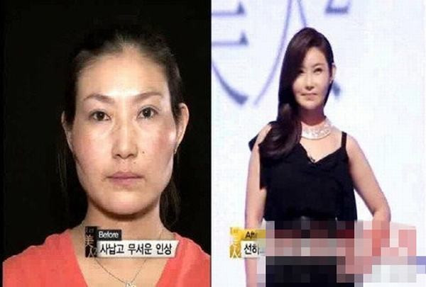 Lee Na Young sở hữu một khuôn mặt góc cạnh với gò má cao và đôi mắt sắc, thêm vào đó làn da ngăm đen khiến cô trông khá dữ tướng. Tuy nhiên, sau khi phẫu thuật thẩm mỹ, Lee đã có một dung mạo mới dịu dàng và hiền hậu hơn rất nhiều. Thậm chí, "vẻ đẹp dao kéo" của cô còn được ví von với diễn viên nổi tiếng Trung Quốc Trương Mạn Ngọc. Lee Na Young sở hữu một khuôn mặt góc cạnh với gò má cao và đôi mắt sắc, thêm vào đó làn da ngăm đen khiến cô trông khá dữ tướng. Tuy nhiên, sau khi phẫu thuật thẩm mỹ, Lee đã có một dung mạo mới dịu dàng và hiền hậu hơn rất nhiều. Thậm chí, "vẻ đẹp dao kéo" của cô còn được ví von với diễn viên nổi tiếng Trung Quốc Trương Mạn Ngọc.