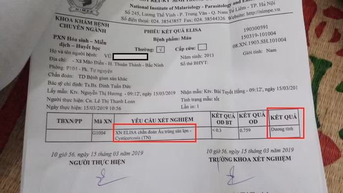 Một trường hợp xã Mão Điền dương tính với ấu trùng sán lợn. Ảnh: V.P.