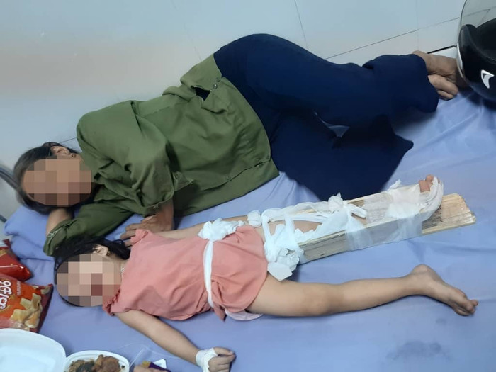 Hình ảnh cháu A. bị gãy chân phải nẹp cố định rất đau đớn. Ảnh: NVCC. Hình ảnh cháu A. bị gãy chân phải nẹp cố định rất đau đớn. Ảnh: NVCC.