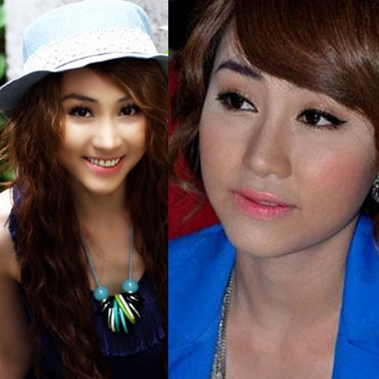 So với thời mặt chữ V, Ngân Khánh sau đó "cứng đơ" vì "dao kéo" thất bại