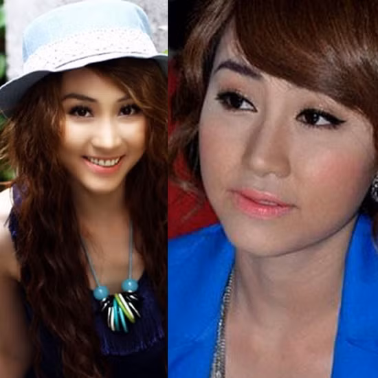 So với thời mặt chữ V, Ngân Khánh sau đó "cứng đơ" vì "dao kéo" thất bại