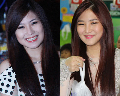 Sự thay đổi rõ rệt trên gương mặt của Hương Tràm.