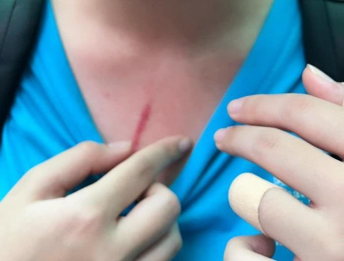 Vụ việc ISHCMC-AA (Ảnh: FB T.H.T) Vụ việc ISHCMC-AA (Ảnh: FB T.H.T)