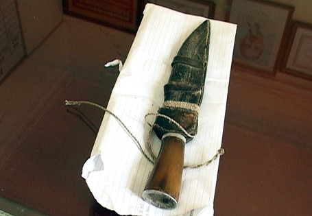 Quan niệm ngu ngốc xúi gã con rể sợ bệnh vảy nến sát hại mẹ vợ bệnh tật Quan niệm ngu ngốc xúi gã con rể sợ bệnh vảy nến sát hại mẹ vợ bệnh tật