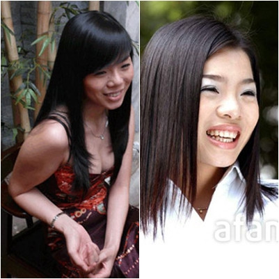 Sống mũi Lệ Quyên trước kia hơi gẫy... Sống mũi Lệ Quyên trước kia hơi gẫy...