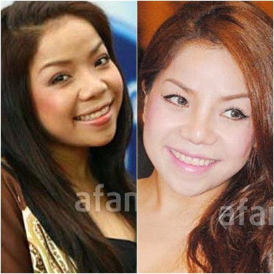 Cánh mũi cũng không được nhỏ nhắn và gọn gàng. Cánh mũi cũng không được nhỏ nhắn và gọn gàng.