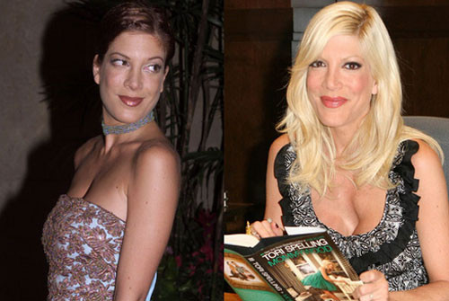 Bộ ngực lõm của Tori Spelling cho thấy cô đã đi bơm ngực. Sau nhiều lần chối bỏ thì đến cuối năm 2008 thì cô đã thừa nhận điều đó.