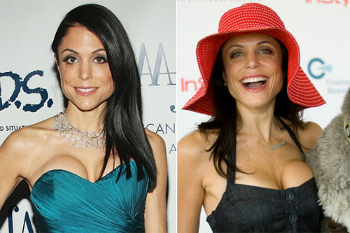 Bethenny Frankel với bộ ngực bơm xấu được ví như hai quả cam dán lên.