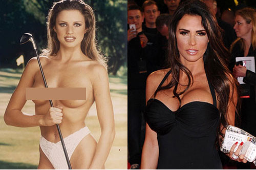 Katie Price đã bơm ngực lên cỡ khủng và cô phải hối tiếc vì chúng quá nặng nề.