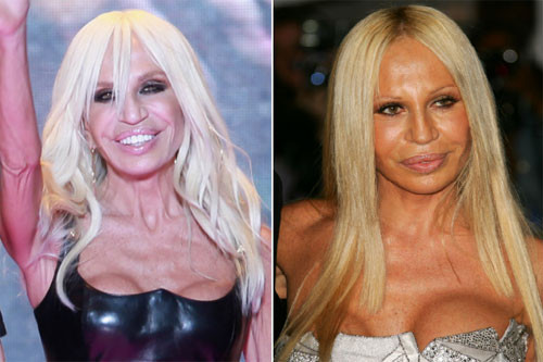 Donatella Versace không thể níu kéo lại vẻ đẹp sau khi 'nâng cấp' vòng 1.