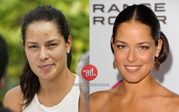 Ana Ivanovic Ana Ivanovic