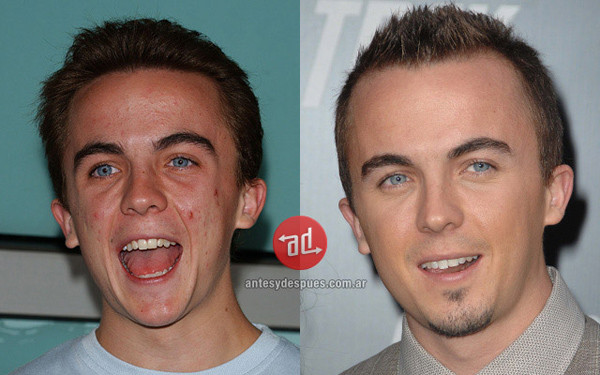 Frankie Muniz Frankie Muniz