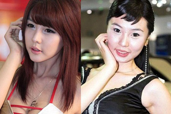 Những hình ảnh trước vào sau cuộc trùng tu nhan sắc của Lee Ji Woo: Những hình ảnh trước vào sau cuộc trùng tu nhan sắc của Lee Ji Woo: