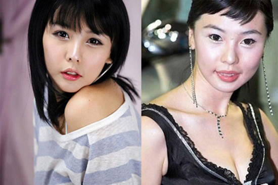 Trang này cho rằng, hình ảnh quá khứ và hiện nay của Lee Ji Woo quá khác biệt đến mức khó có thể nhận ra họ. Công nghệ chỉnh sửa ảnh hay trang điểm cũng không thể làm được điều này. Nhiều cư dân mạng nhận xét nhờ phẫu thuật thẩm mỹ, Ji Woo trông xinh đẹp hơn rất nhiều, chẳng khác nào "quạ hóa thành công". Trang này cho rằng, hình ảnh quá khứ và hiện nay của Lee Ji Woo quá khác biệt đến mức khó có thể nhận ra họ. Công nghệ chỉnh sửa ảnh hay trang điểm cũng không thể làm được điều này. Nhiều cư dân mạng nhận xét nhờ phẫu thuật thẩm mỹ, Ji Woo trông xinh đẹp hơn rất nhiều, chẳng khác nào "quạ hóa thành công".