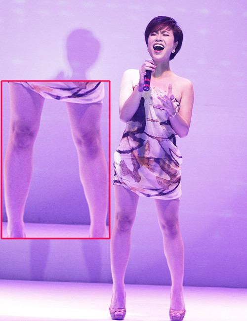 Uyên Linh có lẽ là "đệ nhất chân xấu", bởi chúng cong queo, to, và đầu gối "củ lạc" Uyên Linh có lẽ là "đệ nhất chân xấu", bởi chúng cong queo, to, và đầu gối "củ lạc"