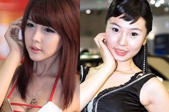 Những hình ảnh trước vào sau cuộc trùng tu nhan sắc của Lee Ji Woo: