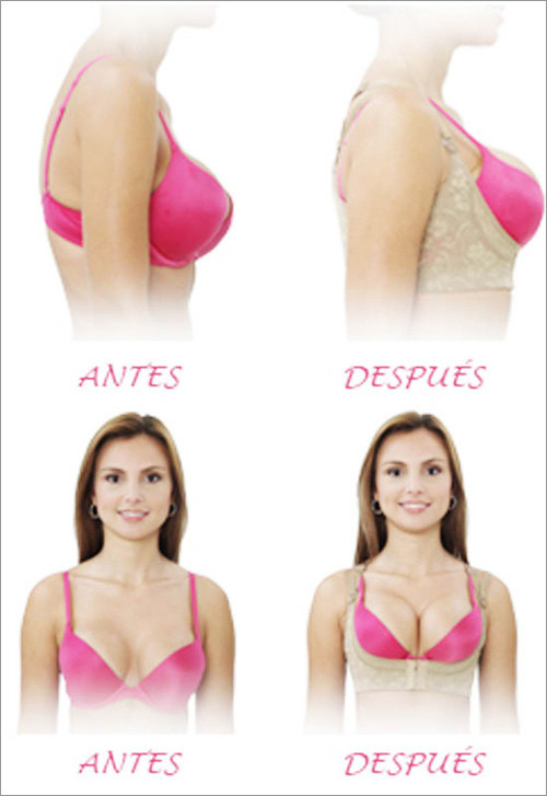 Một tấm bám tổng hợp siêu mềm sẽ giữ tư thế cho xương sống, tạo dáng thẳng cho lưng, qua đó giúp độn, đẩy vòng 1 căng tròn