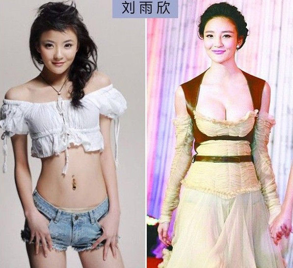 Vòng 1 quá khủng của Lưu Vũ Hân là kết quả của dao kéo hay do áo ngực?