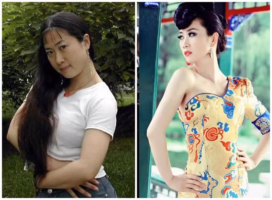 Phù Dung tỷ tỷ Sau phẫu thuật thẩm mỹ Phù Dung tỷ tỷ quả khiến người ta phải ngưỡng mộ khả năng đại tu nhan sắc của các người đẹp. Từ một cô gái quá ục ịch và xấu xí, Phù Dung trông thon gọn hơn với thân hình gợi cảm và gương mặt thanh tú. Dù liên tục phủ nhận việc đã từng thẩm mỹ nhưng ai cũng biết rằng, chỉ có dao kéo mới khiến cô ấy có phép màu biến từ vịt thành thiên nga mà thôi.