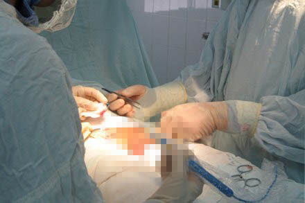 Mà họ còn làm đẹp "của quý".