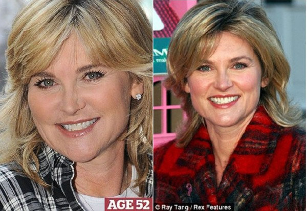 Ca sĩ nổi tiếng người Anh, Dame Shirley Bassey năm 52 tuổi và hiện tại, ở tuổi 75. Ca sĩ nổi tiếng người Anh, Dame Shirley Bassey năm 52 tuổi và hiện tại, ở tuổi 75.