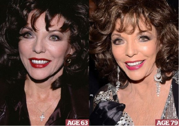 Minh tinh người Anh Joan Collins năm 63 tuổi và 79 tuổi. Minh tinh người Anh Joan Collins năm 63 tuổi và 79 tuổi.
