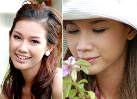 Cùng lúc đó, người ta nhắc tới Quỳnh Chi nhiều hơn, "soi" cô kỹ hơn và bắt đầu nghi ngờ vẻ đẹp của cô không hoàn toàn tự nhiên mà có nhờ đến sự can thiệp của dao kéo: nâng mũi, độn cằm...So sánh những bức hình trước và sau khi thi Miss Teen 2009 người ta dễ dàng nhận ra nhiều điểm khác biệt, sống mũi cao hơn, cánh mũi gọn hơn và gương mặt cũng thon thả hơn.