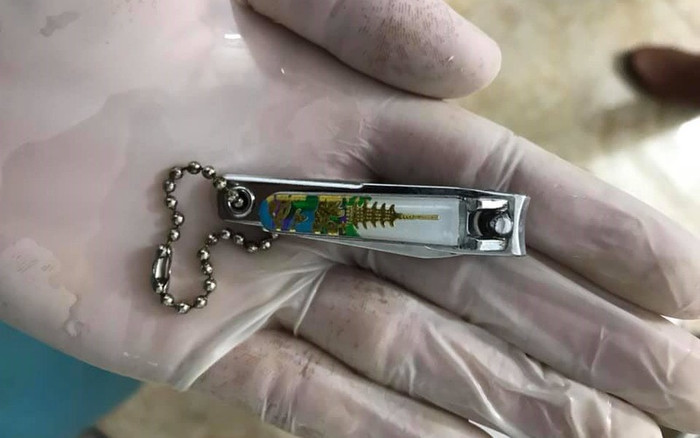 Hình ảnh chiếc bấm móng tay mà bé gái nuốt vào bụng do học theo video trên mạng (Ảnh: Báo điện tử VTV)